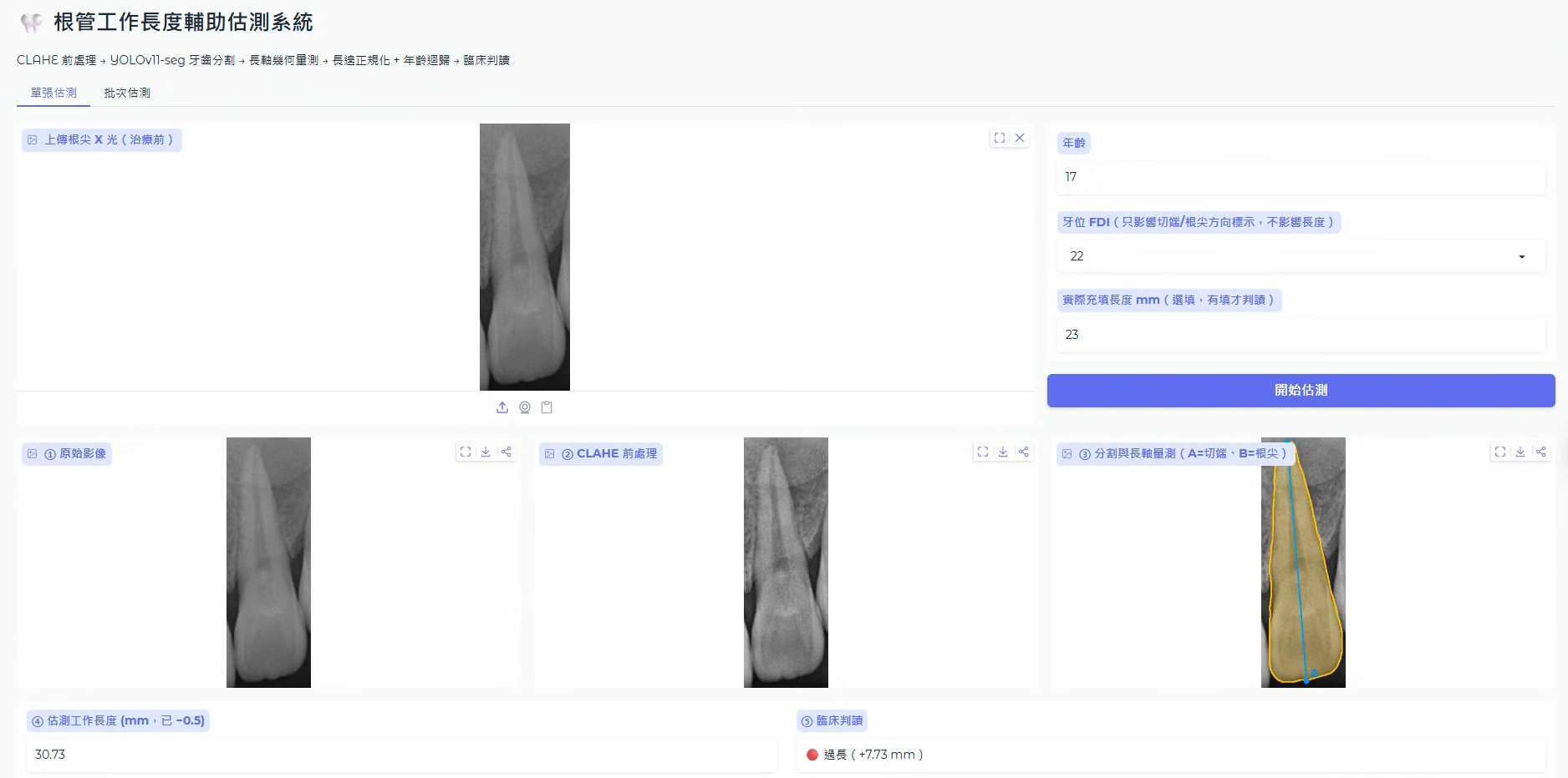 智慧醫療專題